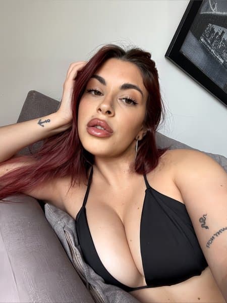 recnidiva